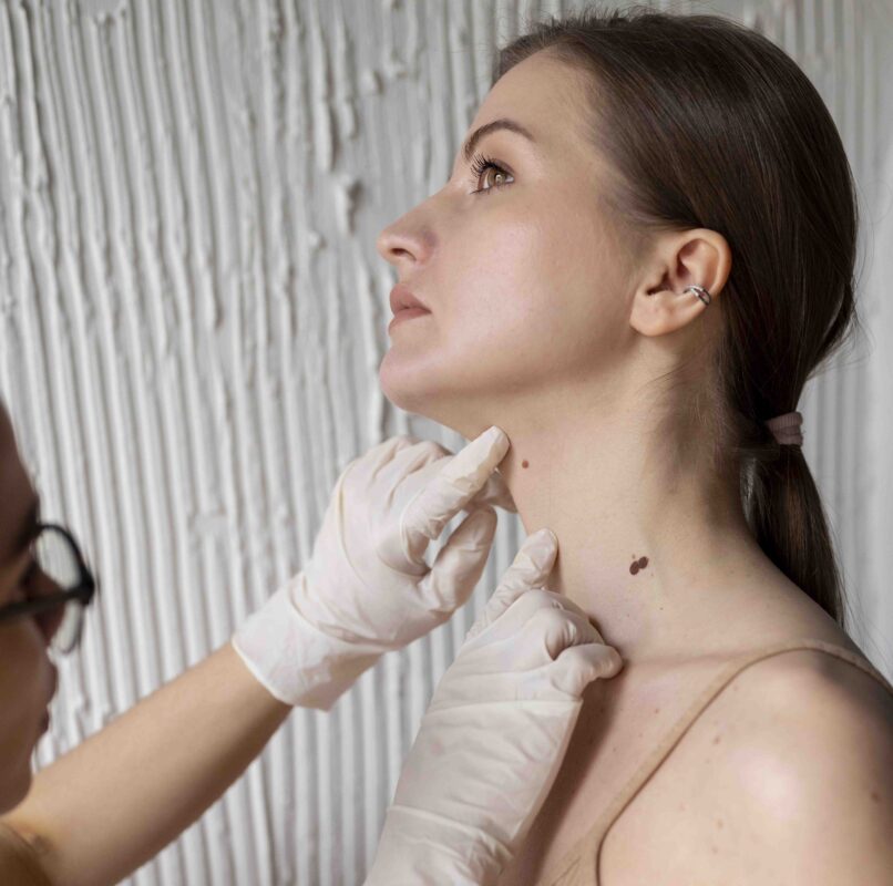 Hyperpigmentation Treatment